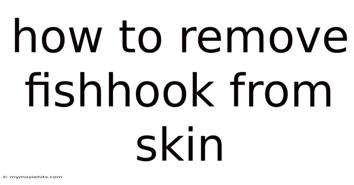 How To Remove Fishhook From Skin