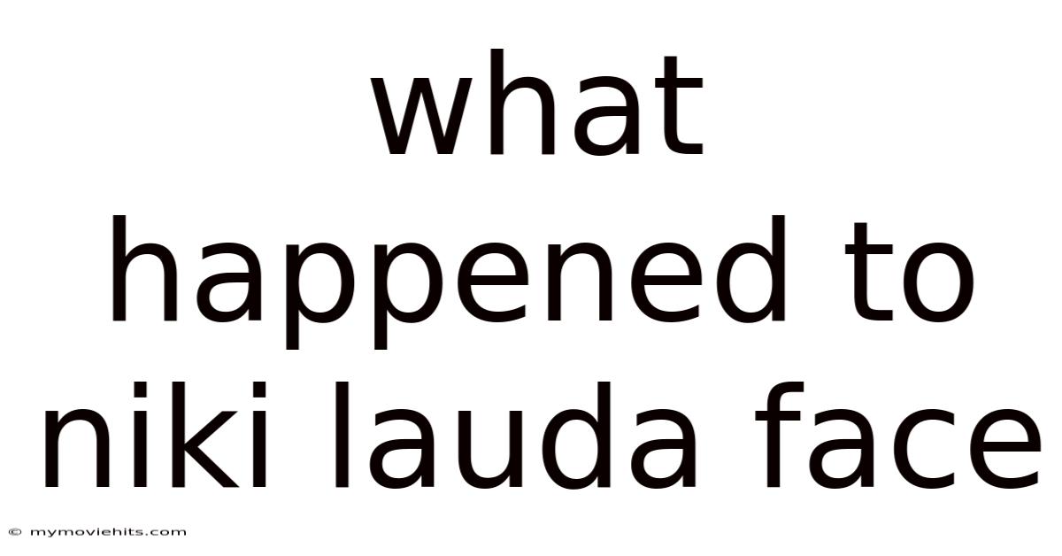 What Happened To Niki Lauda Face